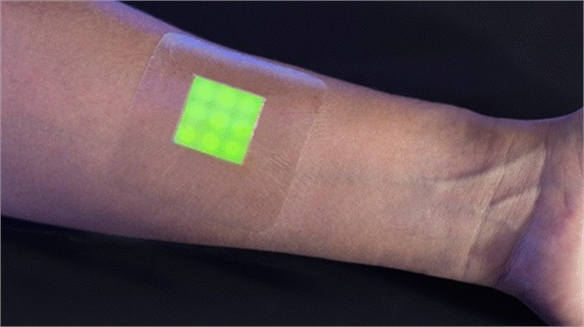 Smart Bandage Predicts Infection